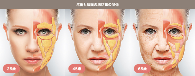 年齢と顔面の脂肪量の関係