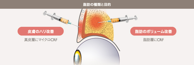 脂肪の種類と目的